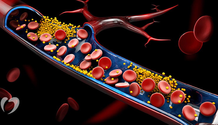 sacha inchi,health benefits of sacha inchi,Health tips,fitness tips