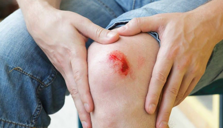 sadabahar,health benefits of sadabahar,Health tips,fitness tips