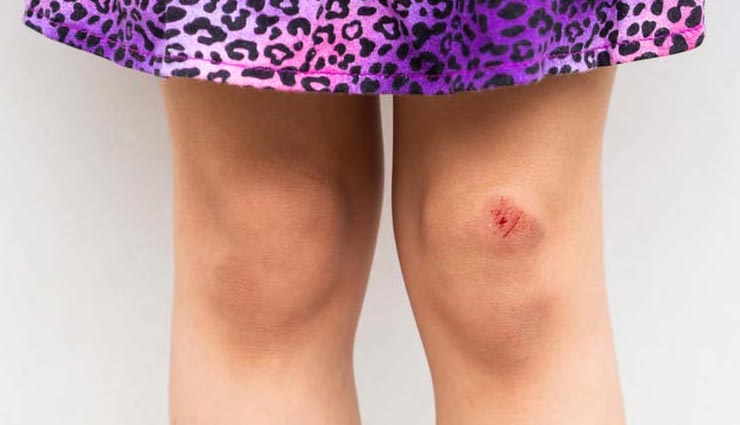 safflower oil,beauty benefits of safflower oil,beauty tips,skin care tips