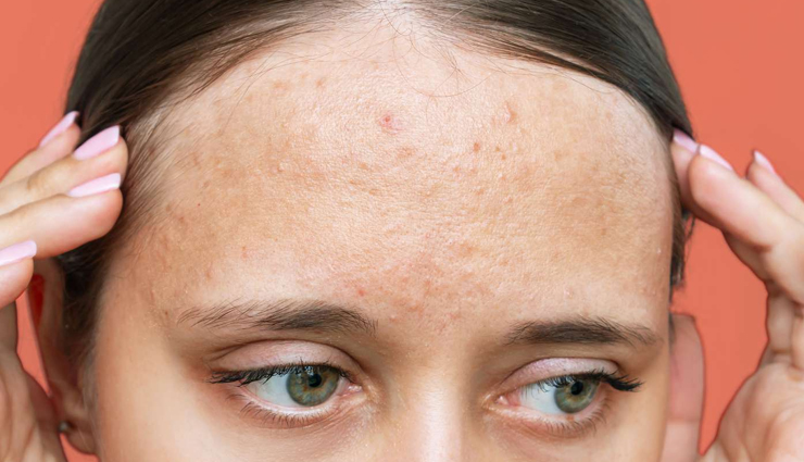 saffron,saffron for skin,beauty benefits of saffron,saffron skin care tips,skin care tips,beauty tips