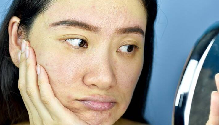 saffron,saffron for skin,beauty benefits of saffron,saffron skin care tips,skin care tips,beauty tips