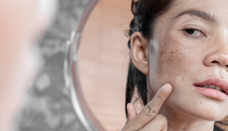 saffron,saffron for skin,beauty benefits of saffron,saffron skin care tips,skin care tips,beauty tips