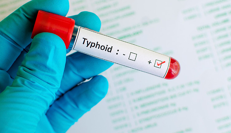 sage,health benefits of sage health tips,fitness tips