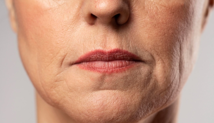 5 DIY Ways to Treat Sagging Skin