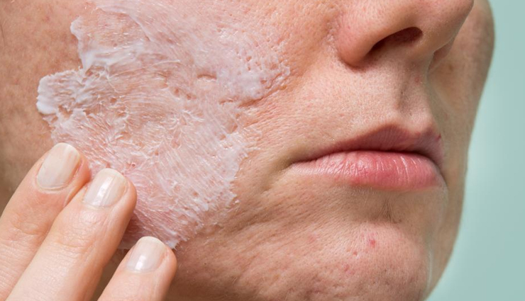 comedonal acne causes,treating comedonal acne,preventing comedonal acne,comedonal acne treatment options,how to manage comedonal acne,blackheads and whiteheads treatment,skincare for acne-prone skin,non-comedogenic skincare products,preventing clogged pores,healthy skincare practices