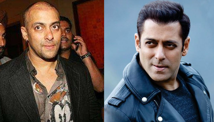 hair transplant,bollywood actors undergo hair transplant,amitabh bacchan,Akshay Kumar,sanjay dutt,kapil sharma,Salman Khan