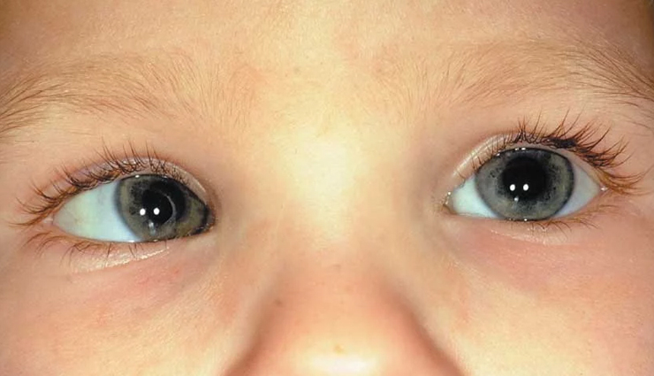 salmon,health benefits of salmon,Health tips,fitness tips