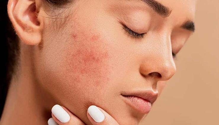 salt,salt for skin care,skin care tips,beauty tips