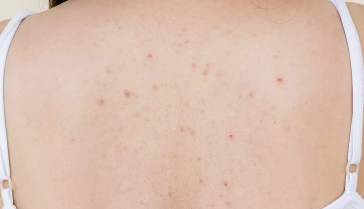 salt,salt for skin care,skin care tips,beauty tips