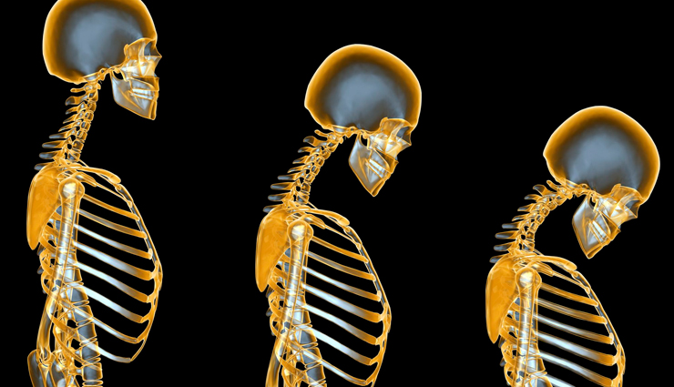 salt,side effects of salt,Health tips,fitness tips