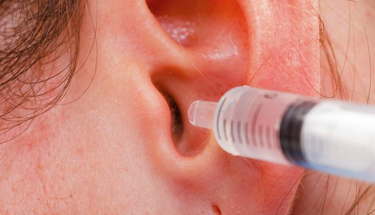 earwax,home remedies to get rid of earwax,earwax problem,earwax  treatment,ear care tips,Health,Health tips
