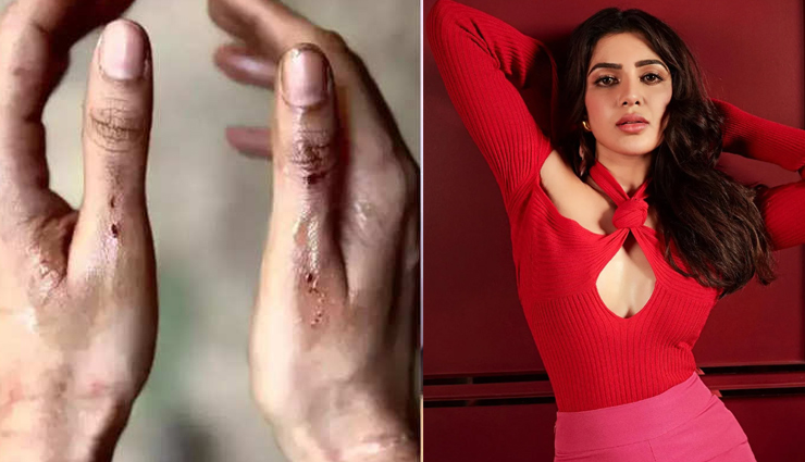  'सिटाडेल' की शूटिंग के दौरान सामंथा रुथ प्रभु को लगी चोट, तस्वीर देख फैंस का टूटा दिल