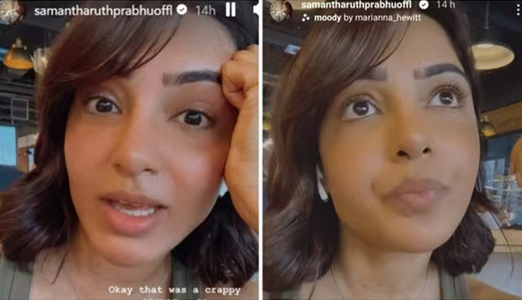 Samantha Ruth Prabhu Opens Up About Skin Issues Amid Myositis Treatment 