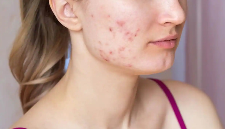 benefits of sandalwood powder to improve your skin health,beauty tips,beauty hacks