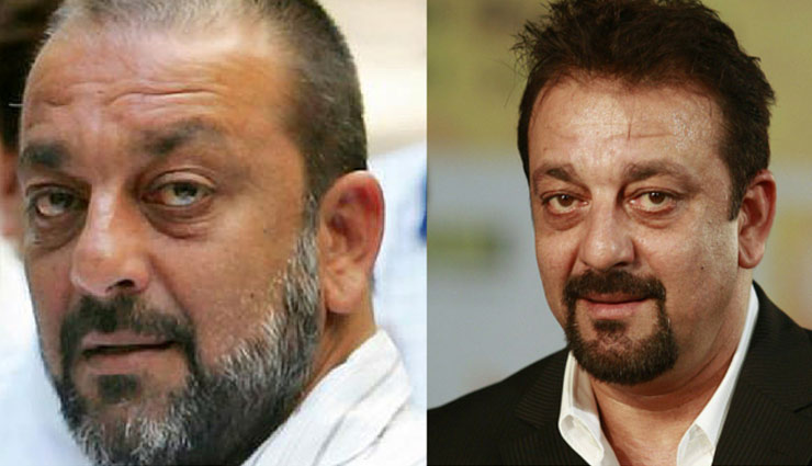 hair transplant,bollywood actors undergo hair transplant,amitabh bacchan,Akshay Kumar,sanjay dutt,kapil sharma,Salman Khan
