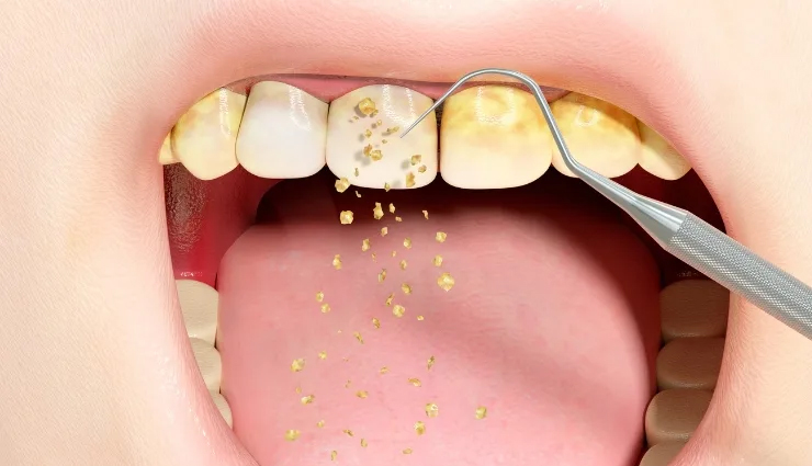 daily habits to keep your teeth healthy,healthy  living,Health tips