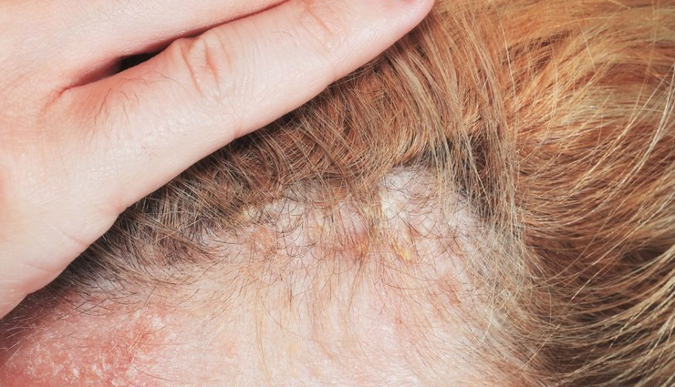 evening primrose oil benefits for hair,using evening primrose oil for hair health,evening primrose oil for scalp moisturization,strengthening hair with evening primrose oil,promoting hair growth with evening primrose oil,evening primrose oil for scalp inflammation,improving hair texture with evening primrose oil,evening primrose oil for preventing hair loss,gla benefits for hair,evening primrose oil scalp treatment,nourishing hair with evening primrose oil,evening primrose oil hair care,evening primrose oil hair growth benefits,evening primrose oil for dry scalp,evening primrose oil for healthier hair,evening primrose oil scalp massage,evening primrose oil for hair strength,evening primrose oil hair mask,evening primrose oil for scalp health,using evening primrose oil for hair nourishment