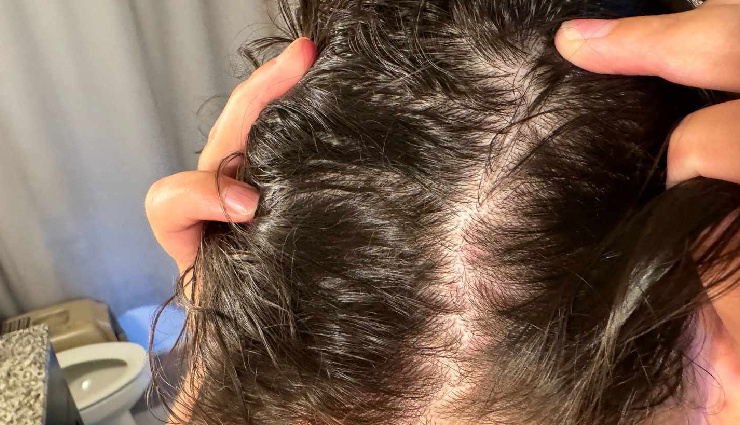 diy lemon remedies,lemon for skin,lemon for hair,lemon beauty tips,lemon face mask,lemon hair mask,lemon for acne,lemon for dandruff,lemon for glowing skin,lemon for hair growth,lemon for pigmentation,lemon for dark spots,lemon home remedies,natural skincare with lemon,lemon for scalp health.