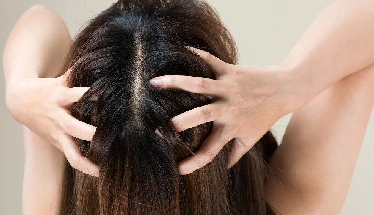 5 Remedies To Prevent Your Scalp from Build Up