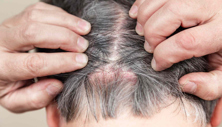 beauty tips,beauty tips in hindi,hair care tips,bay leaf for hair