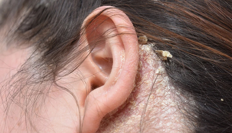 bhringraj oil,bhringraj oil for health,promotes hair growth,prevents hair fall and baldness,treats dandruff and dry scalp,slows down hair graying,treats scalp infection,nourishment to the hair,liver cleanser,aids for healthy skin,relief from headache,improves eyesight,reduces stress and improves sleep pattern,improves memory,Health,Health tips