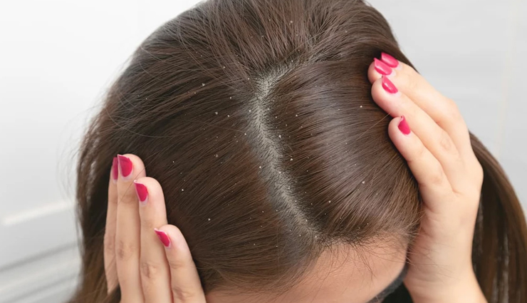 castor oil for hair,use of castor oil for hair,benefits of castor oil for hair,hair care tips,hair