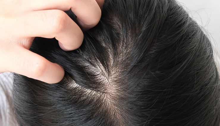 red palm oil hair care,hair growth with red palm oil,red palm oil for healthy hair,using red palm oil as a hair treatment,benefits of red palm oil for hair,natural hair care with red palm oil,red palm oil scalp massage for hair growth,diy red palm oil hair remedies,red palm oil conditioner for hair,tips for applying red palm oil to hair