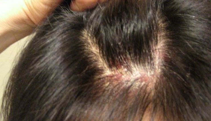 peppermint oil for hair,benefits of peppermint oil for hair,peppermint oil hair growth,peppermint oil scalp stimulation,peppermint oil strengthens hair,peppermint oil prevents hair loss,peppermint oil soothes scalp irritation,peppermint oil controls dandruff,peppermint oil adds shine to hair,peppermint oil hair perfume,peppermint oil combats greasiness,peppermint oil improves scalp health,peppermint oil for scalp circulation,peppermint oil for healthy hair,peppermint oil benefits for hair growth