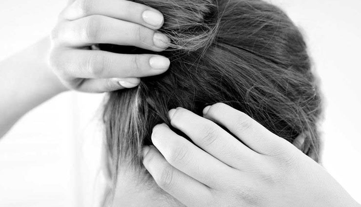 scalp psoriasis,home remedies,home remedies for,scalp care tips,hair care tips,skin care tips,beauty tips