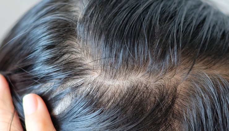 neem for hair,neem benefits for hair,neem hair care,neem oil for hair,neem hair treatment,neem dandruff treatment,scalp health with neem,neem and hair growth,hair loss prevention with neem,neem as a natural conditioner,neem lice treatment,neem scalp infections,neem for scalp health,neem for hair texture,balancing scalp oils with neem