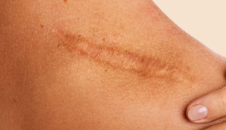 papaya for skin,benefits of papaya for skin,papaya skincare,papain enzyme benefits,papaya exfoliation,papaya antioxidants,hydration with papaya,papaya anti-inflammatory,papaya acne treatment,papaya hyperpigmentation,papaya anti-aging,papaya sun damage repair,papaya scar reduction,papaya skin renewal,papaya tightening and toning