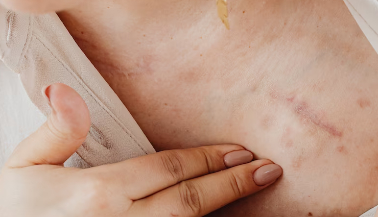 honey skincare benefits,natural humectant,antibacterial properties of honey,anti-inflammatory properties of honey,honey for acne-prone skin,honey for scars,honey for sunburn relief,honey as a moisturizer,natural skincare remedies,honey for glowing skin