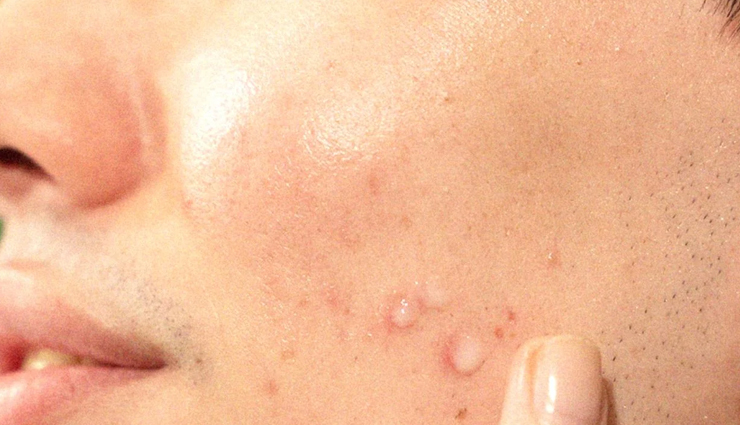 vitamin c for skin,benefits of vitamin c for skin,vitamin c skincare,vitamin c antioxidant protection,vitamin c and collagen synthesis,brightening skin with vitamin c,vitamin c sun protection,vitamin c anti-inflammatory properties,vitamin c wound healing,hydration with vitamin c,vitamin c for even skin tone,vitamin c moisturization,vitamin c for anti-aging,vitamin c skincare routine,topical vitamin c benefits,vitamin c serum for skin,natural skin brightening with vitamin c,vitamin c sunscreen enhancement,vitamin c skincare products,vitamin c and skin health