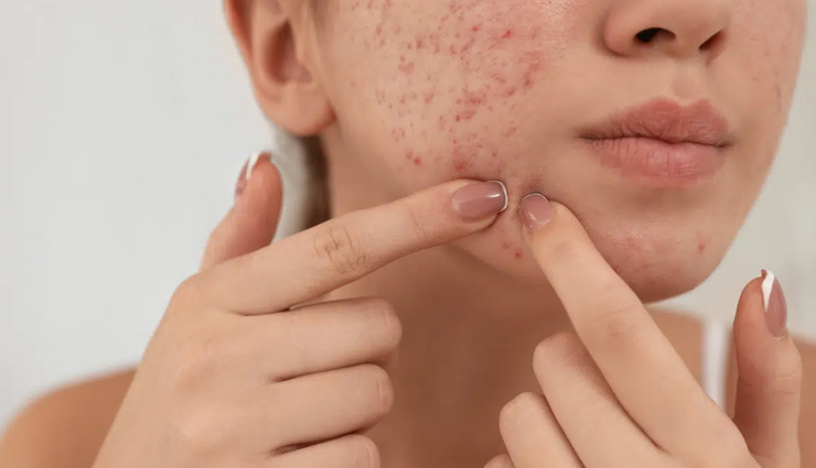 scar prevention tips,how to reduce scars,skincare for scars,scar treatment,scar healing process,minimize scars,healthy skin tips,post-injury skincare,scar care routine,types of scars,natural scar remedies,glowing skin care