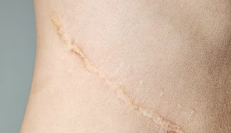 proven health benefits of lily,lily plant benefits for health,lily flower impact on wellness,exploring the health benefits of lilies,lily extracts and their positive effects on health,lily: natural health-promoting properties,nutritional benefits of consuming lily,lily plant compounds and health advantages,lily contribution to overall wellbeing,enhancing health with lily: proven benefits,the healing potential of lily: health benefits,lily positive effects on the body,lily role in herbal medicine and health,lily extracts: supporting health and vitality