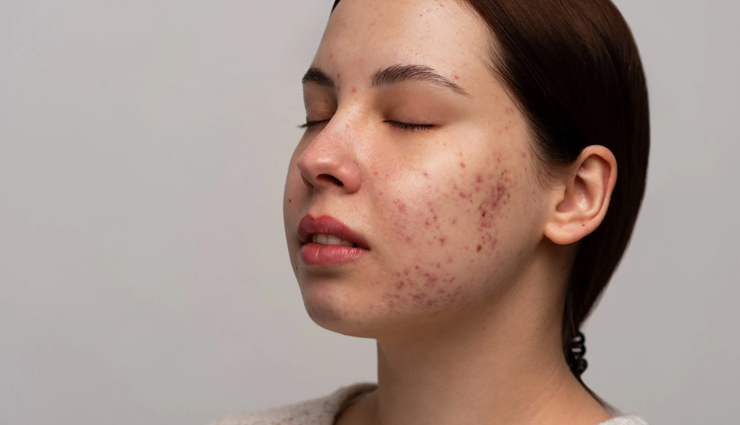 scar prevention tips,how to reduce scars,skincare for scars,scar treatment,scar healing process,minimize scars,healthy skin tips,post-injury skincare,scar care routine,types of scars,natural scar remedies,glowing skin care