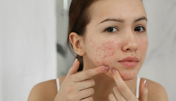 vitamin e oil,vitamin e oil benefits,vitamin e oil for skin,vitamin e oil for skin care,skin care tips,beauty tips,beauty hacks