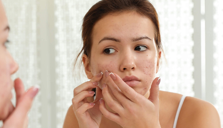 chandan beauty benefits,sandalwood skincare advantages,lesser-known chandan uses,chandan for glowing skin,sandalwood anti-aging properties,chandan skincare secrets,sandalwood skin brightening effects,chandan acne treatment,sandalwood oil control,chandan scar fading,sandalwood anti-inflammatory benefits,chandan aromatherapy benefits,diy chandan face pack recipes,homemade sandalwood face masks,chandan face pack ingredients,sandalwood face pack for acne,diy chandan skincare remedies,chandan and turmeric face pack,sandalwood and rose water face mask,chandan and multani mitti face pack,sandalwood and yogurt face mask,chandan and aloe vera face pack,sandalwood and honey face mask,chandan and cucumber face pack,sandalwood natural skincare tips