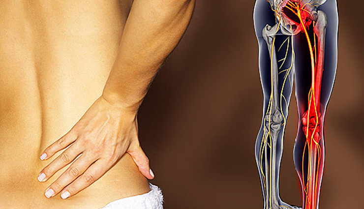 5 Exercises To Treat Nerve Pain