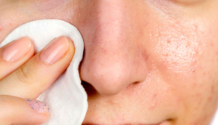 home remedies,home remedies to get rid of oily nose,oily nose treatment,oily nose remedies,skin care,skin care tips
