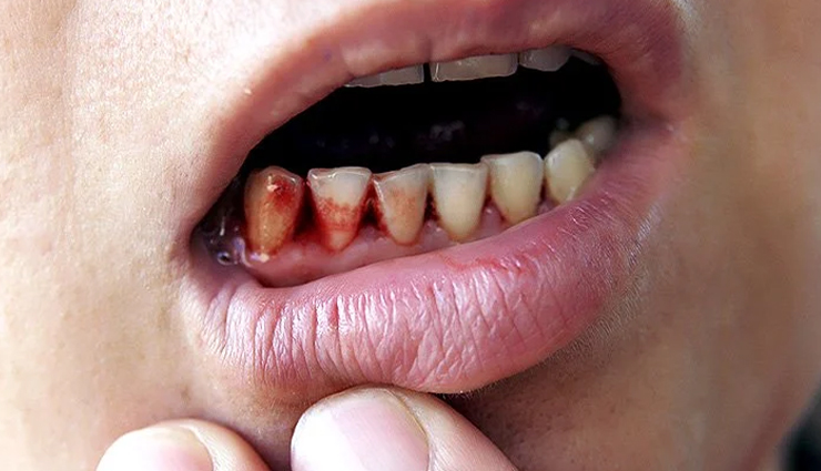 benefits of drinking cranberry juice,cranberry juice,healthy living,Health tips,cranberry juice benefits,cranberry is beneficial for health