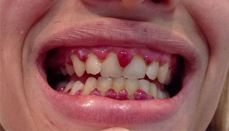 arugula,arugula health benefits,healthy food arugula,healthy food arugula,Health,Health tips