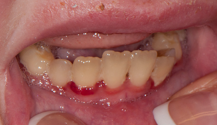 आम खाने के बाद गलती से भी न फेंकना गुठली, कोलेस्ट्रॉल-हृदय रोगों जैसी ये गंभीर बीमारियां होंगी दूर mango seeds,mango seeds health benefits,mango health benefits,healthy food,healthy food to eat,Health,health news