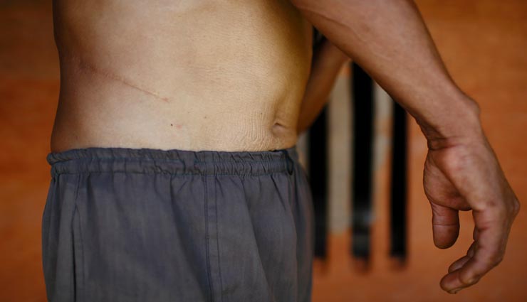 इस गांव में सभी जी रहे केवल एक किडनी के सहारे, कारण झकझोर देने वाला weird news,weird village,nepal village,everyone sold their kidneys