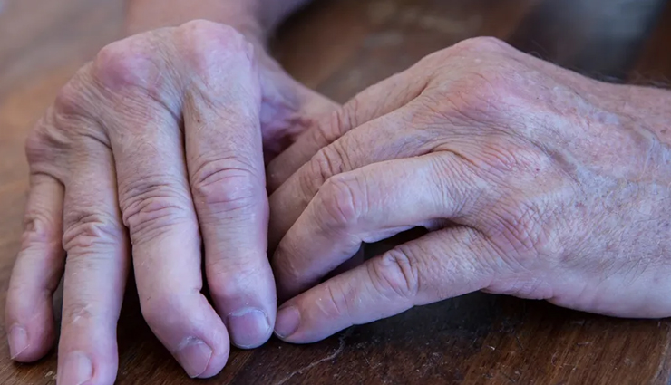 arthritis care,senior citizen arthritis support,elderly arthritis management,senior health tips for arthritis,arthritis management for seniors,caregiving for seniors with arthritis,arthritis relief for older adults,senior citizen joint health,arthritis management tips,elderly arthritis care advice,senior citizen wellness tips,arthritis-friendly living tips,senior health and arthritis management,arthritis prevention for seniors,healthy aging with arthritis,senior citizen mobility and arthritis,arthritis pain relief for the elderly,senior-friendly arthritis treatments,arthritis lifestyle adjustments for seniors,senior citizen wellness strategies