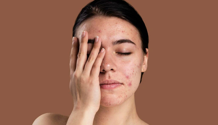 rose water benefits for skin,hydrating properties of rose water,rose water as a natural toner,balancing ph with rose water,anti-inflammatory rose water uses,antioxidant-rich rose water skincare,anti-aging effects of rose water,refreshing facial mist rose water,rose water hair care benefits,calming effects of rose water aroma,rose water for dry skin hydration,rose water for acne and eczema,rose water for reducing redness,rose water in anti-pollution skincare,rose water to diminish fine lines,rose water rejuvenating spritz,rose water conditioner for hair,rose water in aromatherapy,rose water for stress relief,rose water skincare routine