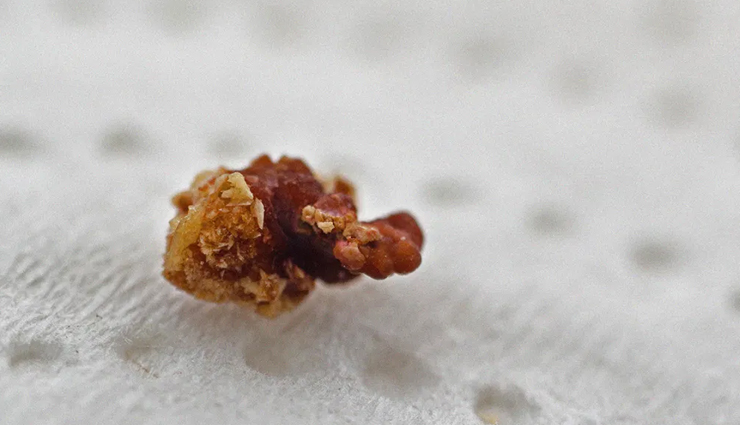 side effects of sesame seed or oil,Health tips,fitness tips