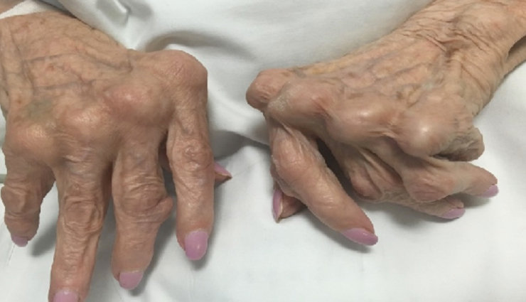 shatavari churna,health benefits of shatavari churna,Health tips,fitness tips