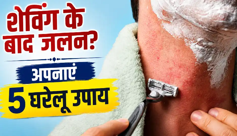 शेविंग के बाद त्वचा में हो रही जलन को ऐसे करें शांत, ये 5 घरेलू उपाय देंगे राहत