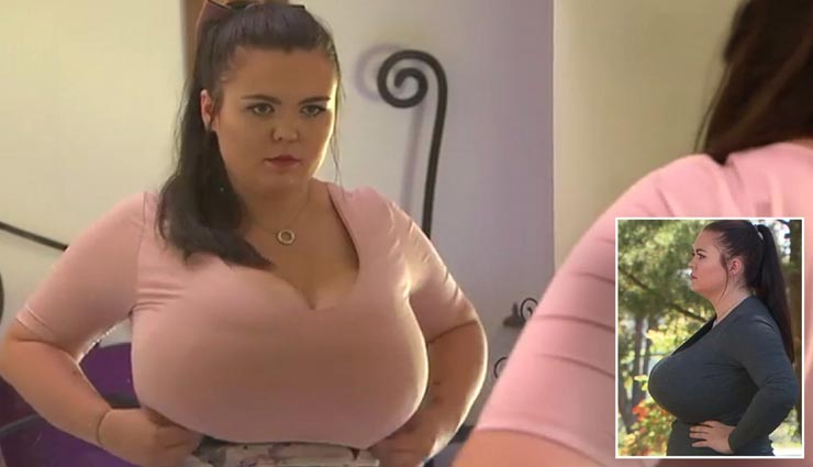 महिला की परेशानी बनी ब्रेस्ट की बड़ी साइज, वजह चौंकाने वाली